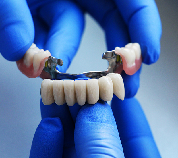 Linden Dental Bridges