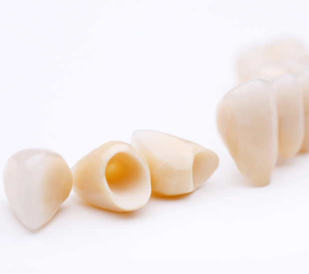 Linden Dental Crowns and Dental Bridges