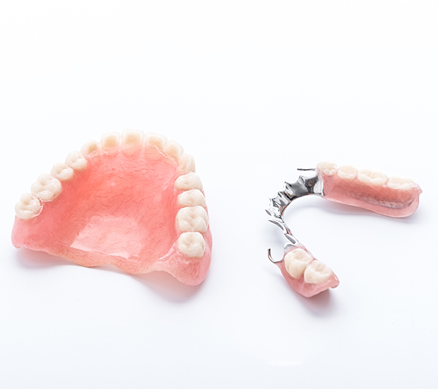 Linden Partial Dentures for Back Teeth